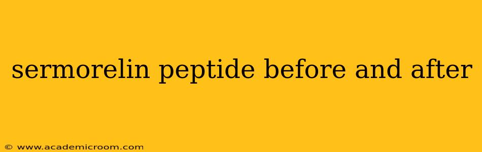 sermorelin peptide before and after