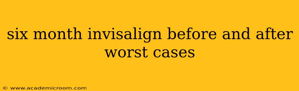 six month invisalign before and after worst cases