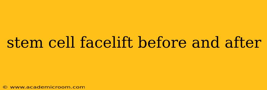 stem cell facelift before and after