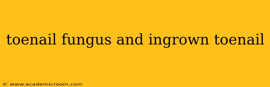 toenail fungus and ingrown toenail