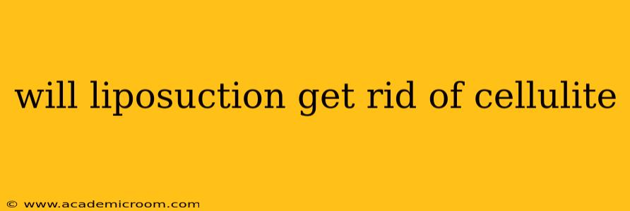 will liposuction get rid of cellulite